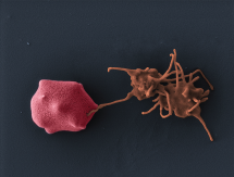 EM image