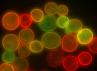 Microscopic photo of yeast membrane