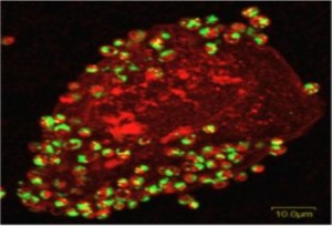 A Flourescing yeast and bucal cell Canida Albicans