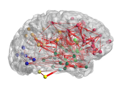 A diagram of a brain, showing connectors