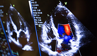 Cardio scan image