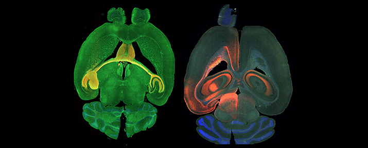 Two brain scans