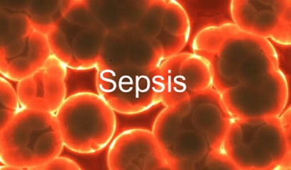 Australian system to detect sepsis is best