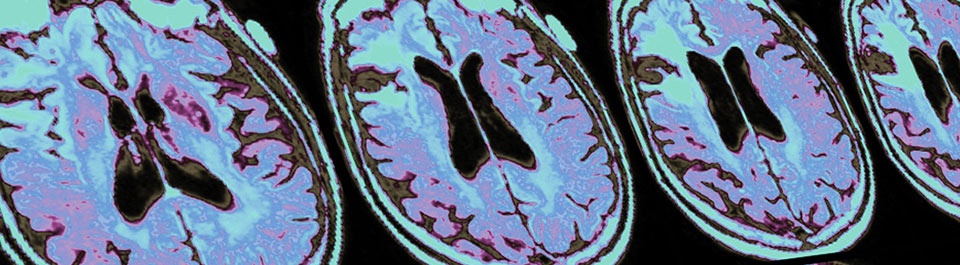 Neuroimagery, several slices of a colourful brain scan.