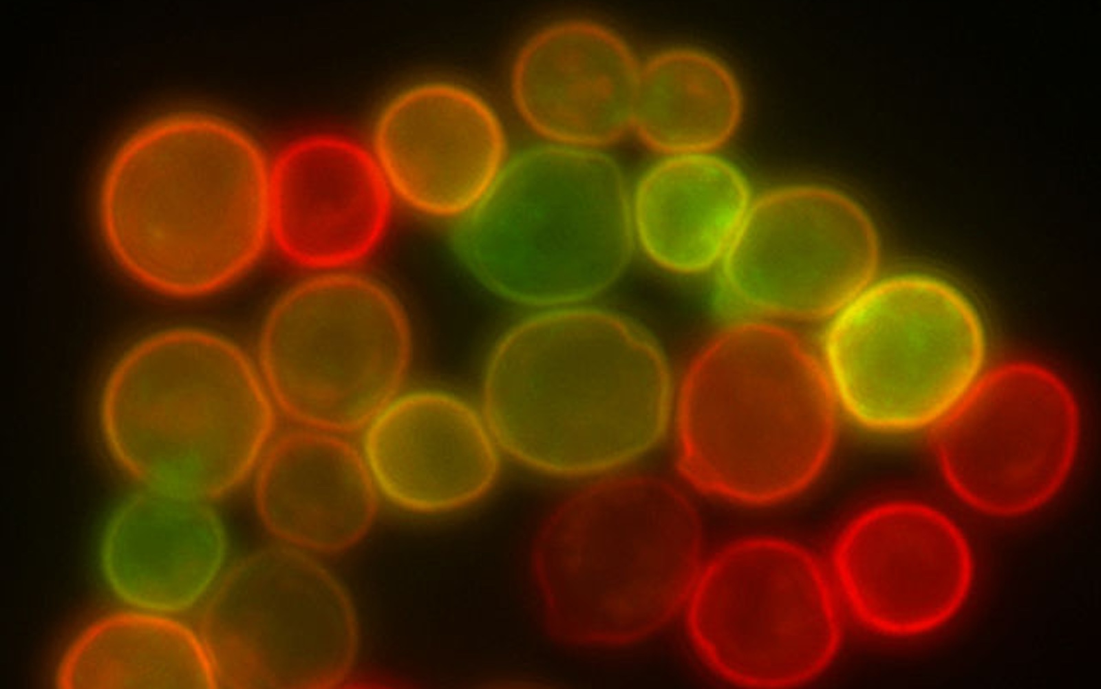 Yeast (S. cerevisiae) cell membrane visualized by some membrane proteins fused with RFP and GFP fluorescent markers. Imposition of light from both of markers results in yellow colour.  Masur  Wikimedia Creative Commons Attribution 2.5