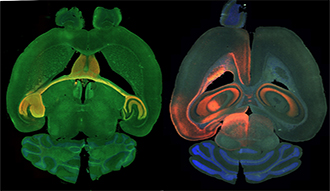 A green brain scan