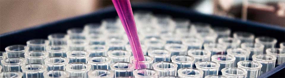 A tray of test tubes with a pink dropper going into one 