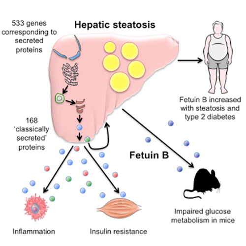 Hepatic Steatosis