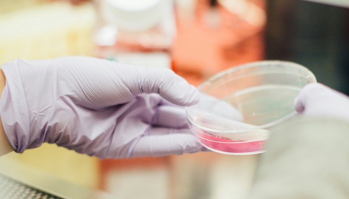 Gloved hand with petri dish by Drew Hays on Unsplash