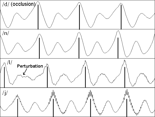 Macquarie University The Waveforms Of Speech